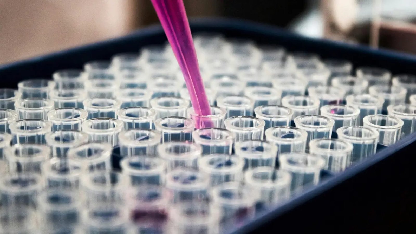 © Louis Reed/ Unsplash