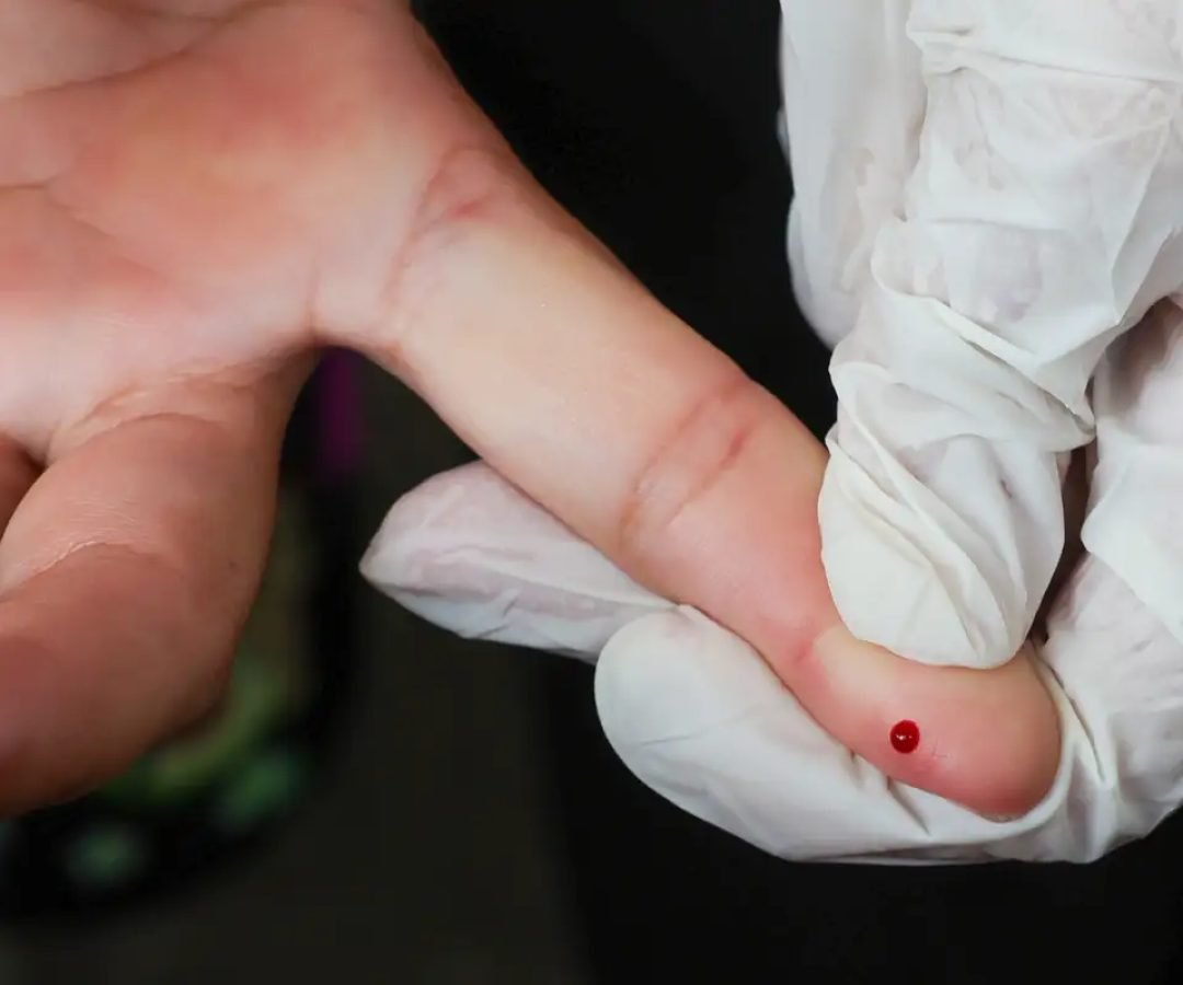 © Fabio Rodrigues-Pozzebom/ Agênc